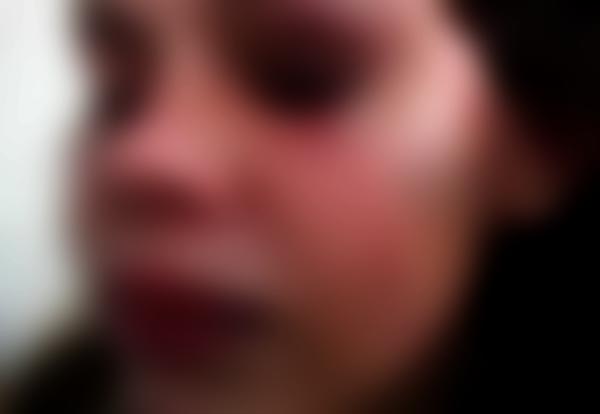 Garota de 15 anos estuprada na Zona Rural de Poções
