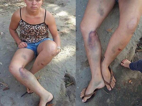 Mulher denuncia marido por agressão e espancamento