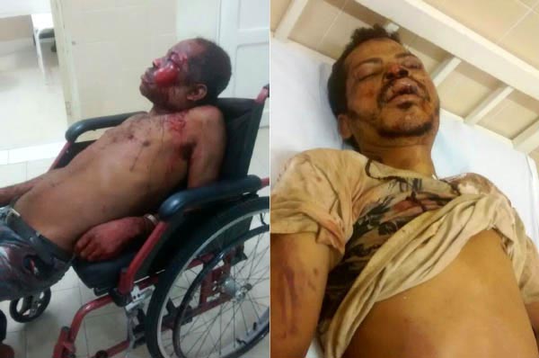 Briga de irmão causa morte em Boa Nova